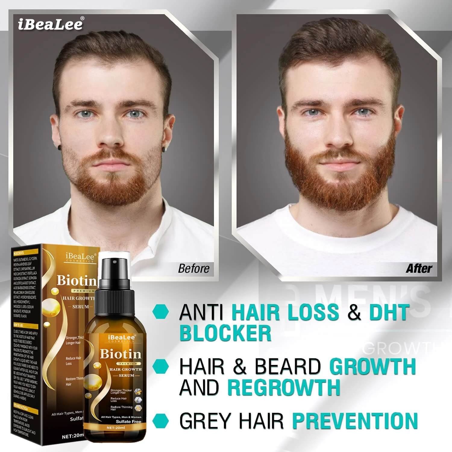 best hair growth serum for men